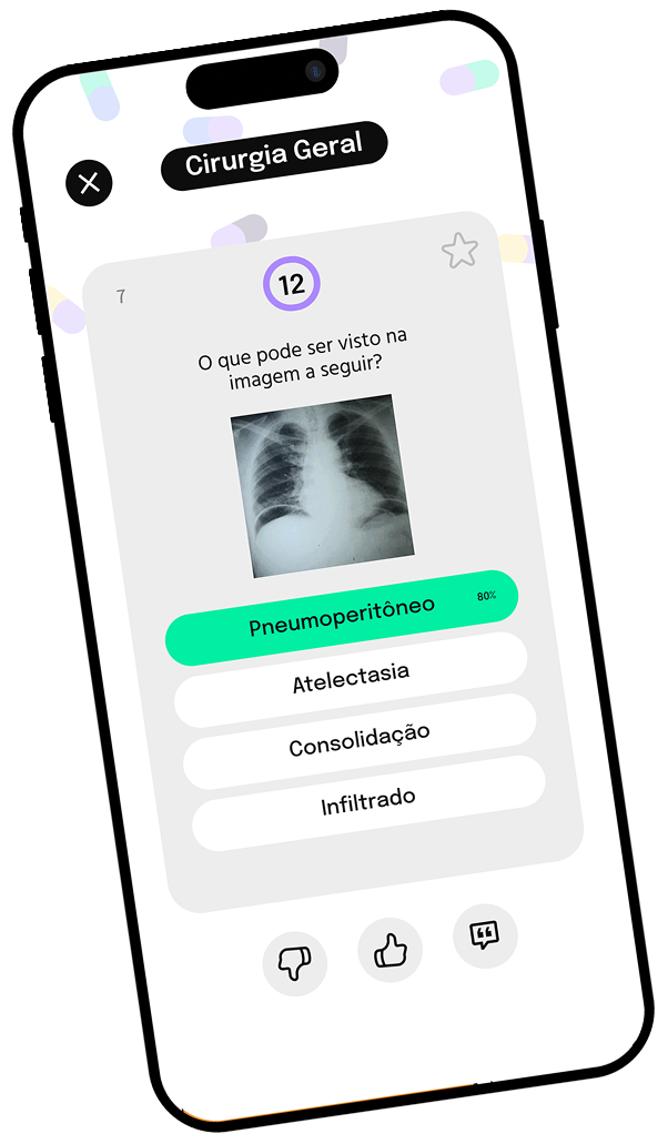 Tela de uma questão de Cirurgia Geral